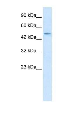 Western Blot: ZNF651 Antibody [NBP1-80145]