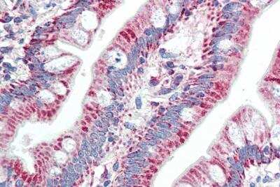 Immunohistochemistry-Paraffin: ZNF652 Antibody [NBP1-97753]