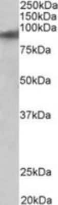 Western Blot: ZNF652 Antibody [NBP1-97753]