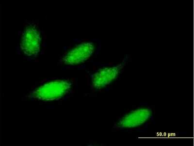 Immunocytochemistry/ Immunofluorescence: ZNF653 Antibody [H00115950-B01P]