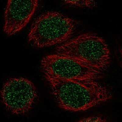 Immunocytochemistry/ Immunofluorescence: ZNF653 Antibody [NBP2-48567]