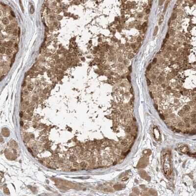 Immunohistochemistry-Paraffin: ZNF653 Antibody [NBP2-48567]