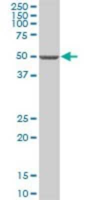 Western Blot: ZNF653 Antibody [H00115950-B01P]