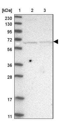 Western Blot: ZNF653 Antibody [NBP1-86828]