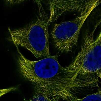 Immunocytochemistry/ Immunofluorescence: ZNF654 Antibody [NBP2-69055]