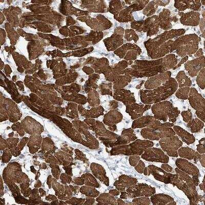 Immunohistochemistry-Paraffin: ZNF654 Antibody [NBP1-83795]