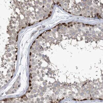 Immunohistochemistry-Paraffin: ZNF654 Antibody [NBP2-48653]