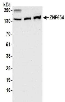 Western Blot: ZNF654 Antibody [NBP2-32110]