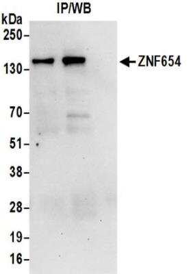 Western Blot: ZNF654 Antibody [NBP2-32110]