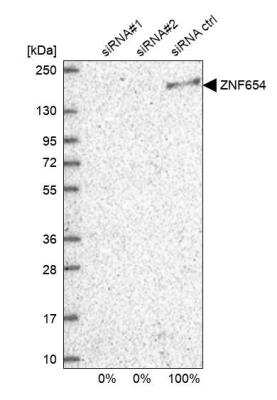 Western Blot: ZNF654 Antibody [NBP2-48653]