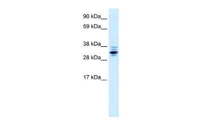 Western Blot: ZNF654 Antibody [NBP3-10965]