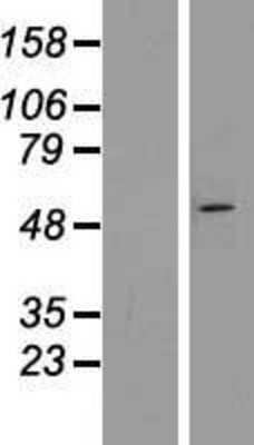 Western Blot: ZNF654 Overexpression Lysate [NBP2-06823]