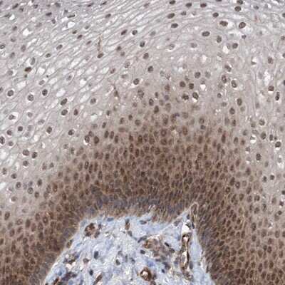 Immunohistochemistry-Paraffin: ZNF655 Antibody [NBP1-80625]