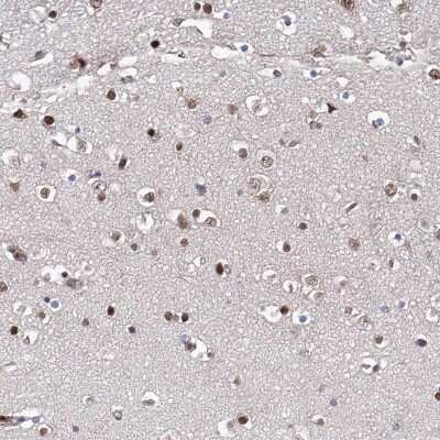 Immunohistochemistry-Paraffin: ZNF655 Antibody [NBP1-80625]