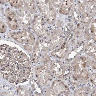 Immunohistochemistry-Paraffin: ZNF655 Antibody [NBP1-80625]