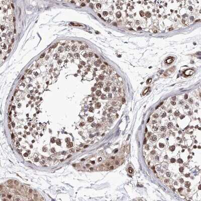 Immunohistochemistry-Paraffin: ZNF655 Antibody [NBP1-80625]