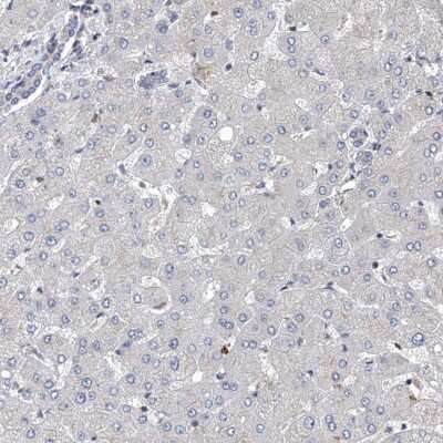 Immunohistochemistry-Paraffin: ZNF655 Antibody [NBP1-80625]