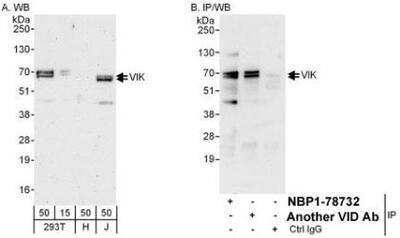 Western Blot: ZNF655 Antibody [NBP1-78732]