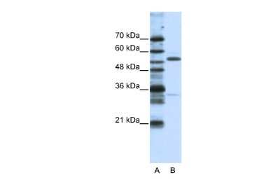 Western Blot: ZNF655 Antibody [NBP2-88720]