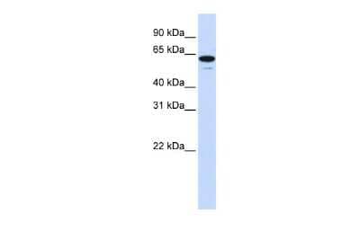 Western Blot: ZNF655 Antibody [NBP2-88721]