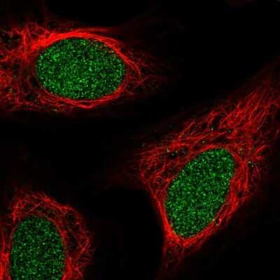 Immunocytochemistry/ Immunofluorescence: ZNF658 Antibody [NBP2-30748]