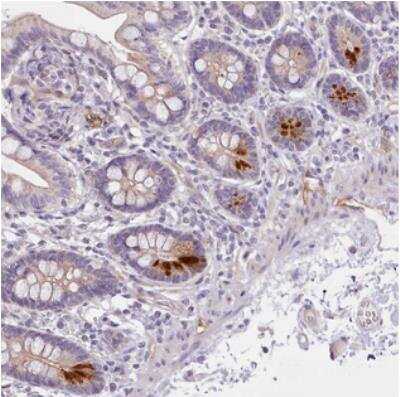 Immunohistochemistry: ZNF658 Antibody [NBP2-30793]