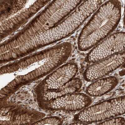 Immunohistochemistry-Paraffin: ZNF660 Antibody [NBP1-81952]