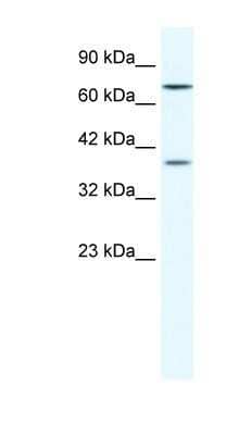 Western Blot: ZNF660 Antibody [NBP1-80190]