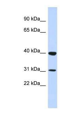 Western Blot: ZNF660 Antibody [NBP1-80429]