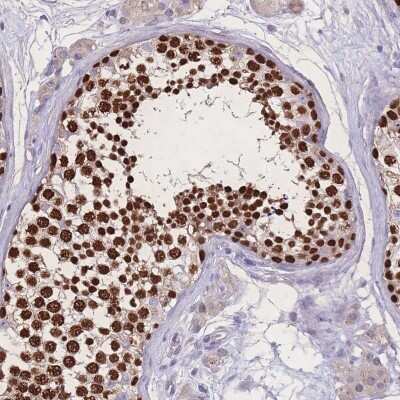 Immunohistochemistry: ZNF662 Antibody [NBP2-31982]