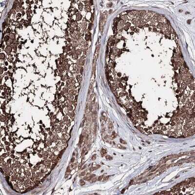 Immunohistochemistry-Paraffin: ZNF662 Antibody [NBP2-32632]