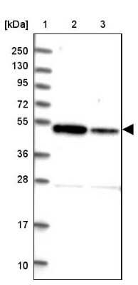 Western Blot: ZNF662 Antibody [NBP2-32632]