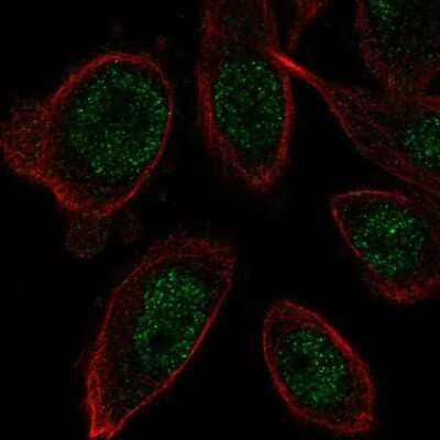 Immunocytochemistry/ Immunofluorescence: ZNF664 Antibody [NBP2-56858]