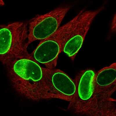 Immunocytochemistry/ Immunofluorescence: ZNF665 Antibody [NBP2-13590]