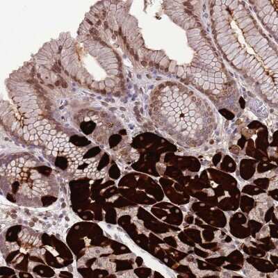 Immunohistochemistry-Paraffin: ZNF665 Antibody [NBP2-13590]