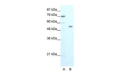 Western Blot: ZNF665 Antibody [NBP2-83887]