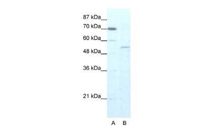 Western Blot: ZNF665 Antibody [NBP2-83888]