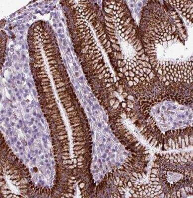 Immunohistochemistry-Paraffin: ZNF667 Antibody [NBP2-13591]