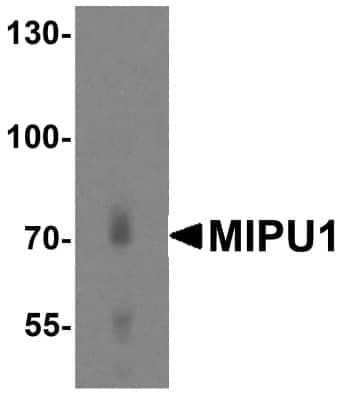 Western Blot: ZNF667 AntibodyBSA Free [NBP1-77357]