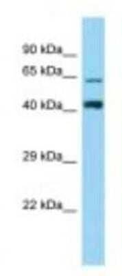 Western Blot: ZNF667 Antibody [NBP1-98333]