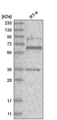 Western Blot: ZNF667 Antibody [NBP2-58273]