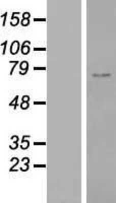 Western Blot: ZNF667 Overexpression Lysate [NBP2-06470]