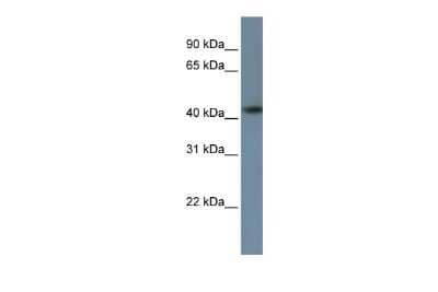 Western Blot: ZNF669 Antibody [NBP3-10519]