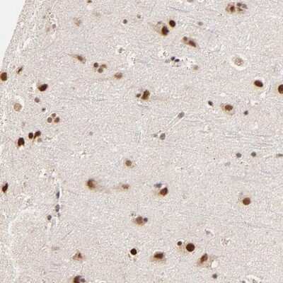 Immunohistochemistry-Paraffin: ZNF670 Antibody [NBP1-81218]