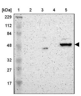 Western Blot: ZNF670 Antibody [NBP1-81218]