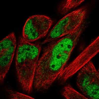 Immunocytochemistry/ Immunofluorescence: ZNF671 Antibody [NBP1-92641]