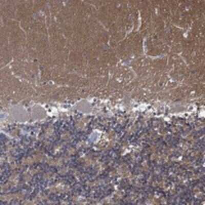 Immunohistochemistry-Paraffin: ZNF671 Antibody [NBP3-17783]