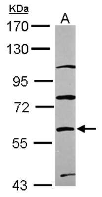 Western Blot: ZNF671 Antibody [NBP2-21039]