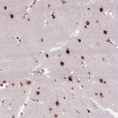 Immunohistochemistry: ZNF672 Antibody [NBP2-47563]