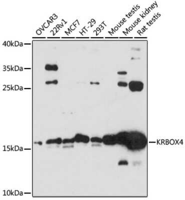 Western Blot: ZNF673 AntibodyAzide and BSA Free [NBP2-93582]